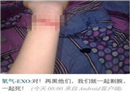អ្នកគាំទ្ររបស់ EXO-M ចង់អារដៃសំលាប់ខ្លួន